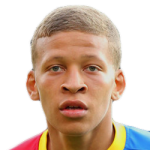 Dwight Gayle